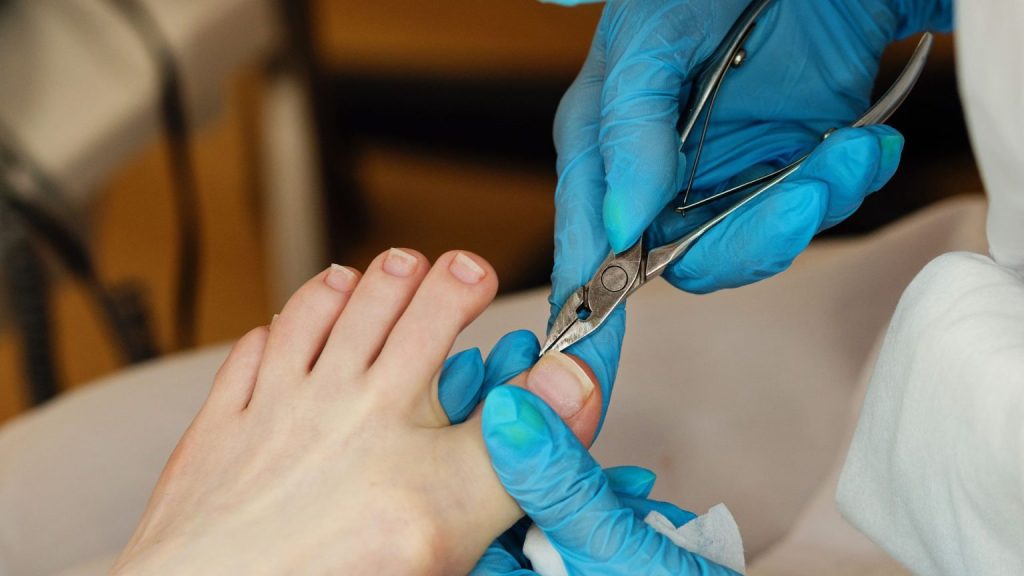 When Does an Ingrown Toenail Doctor Rule Out Other Nail Disorders?